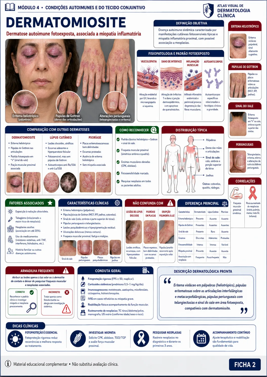 Ficha visual sobre dermatomiosite do módulo de condições autoimunes e do tecido conjuntivo