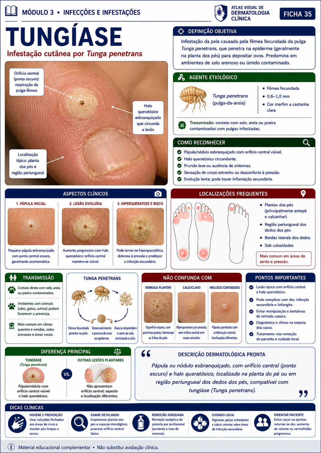 Ficha visual sobre tungíase do módulo de infecções e infestações