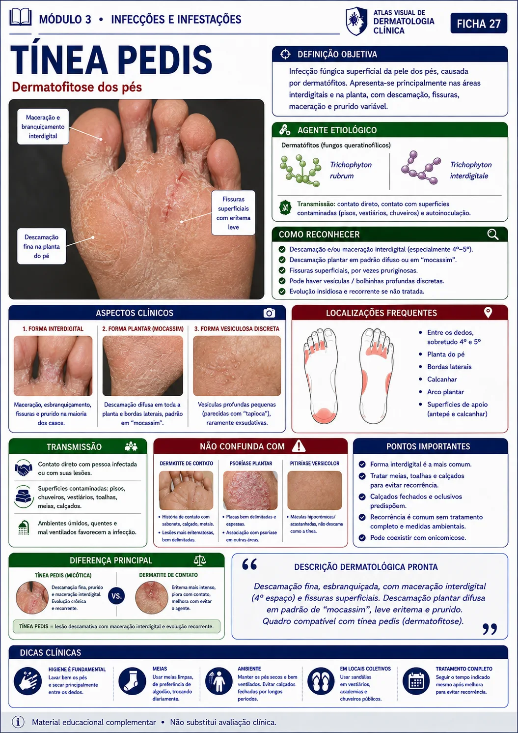 Ficha visual sobre tínea pedis do módulo de infecções e infestações