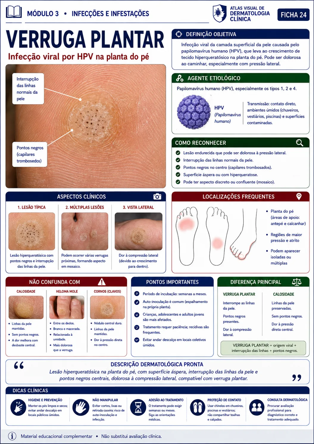 Ficha visual sobre verruga plantar do módulo de infecções e infestações