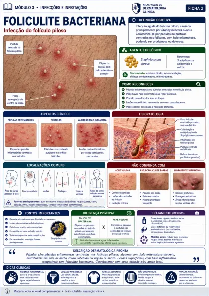 Ficha visual de dermatologia sobre foliculite bacteriana