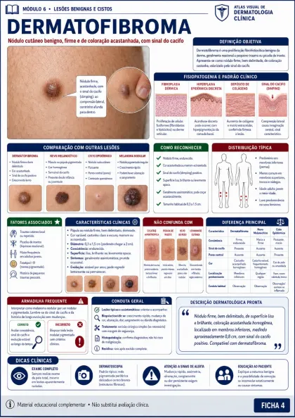 Ficha visual de dermatologia sobre dermatofibroma