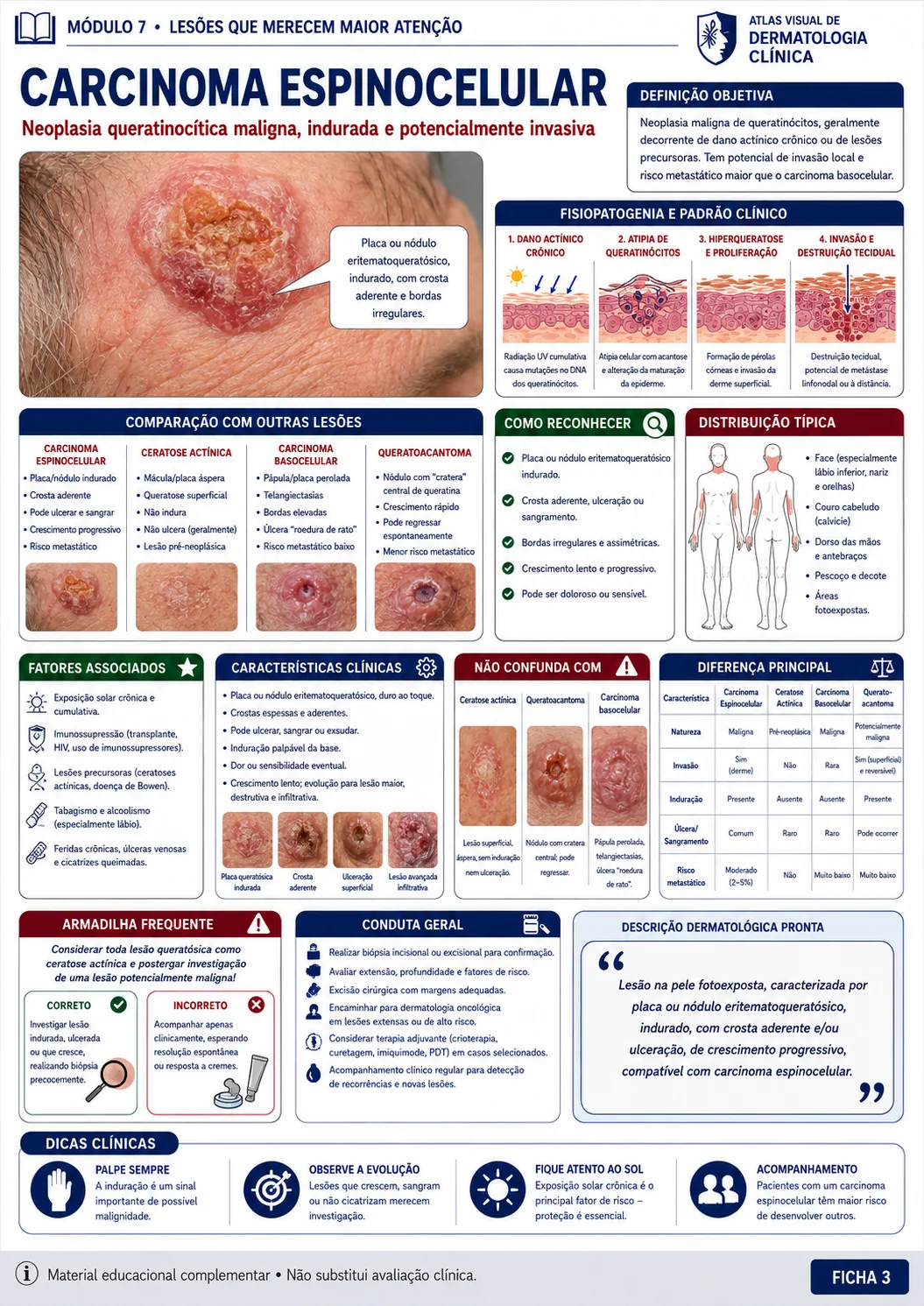Ficha visual de dermatologia sobre carcinoma espinocelular